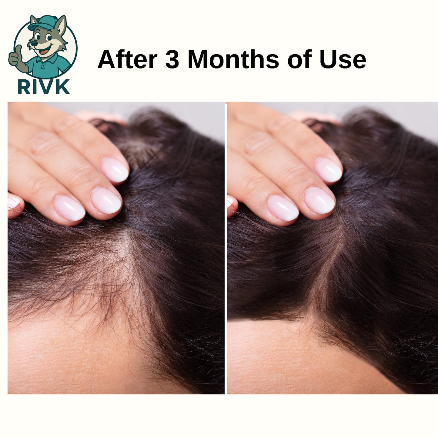 RIVK Ayurvedic Shampoo - 12 Herbal Formula for Strong Roots & Less Hair Fall, Pack of 2 (200g+200g)